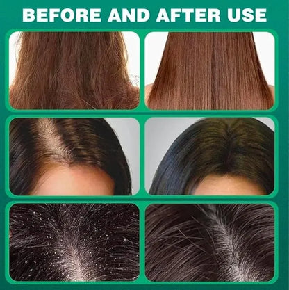 صابونة شامبو  الاصلي بسبع أعشاب لتقوية الشعر ومكافحة القشرة