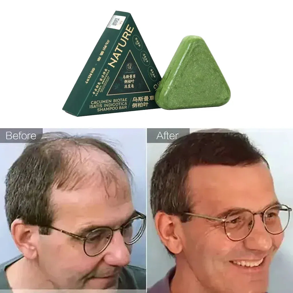 صابونة شامبو  الاصلي بسبع أعشاب لتقوية الشعر ومكافحة القشرة