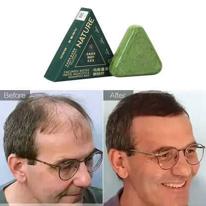 صابونة شامبو  الاصلي بسبع أعشاب لتقوية الشعر ومكافحة القشرة